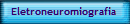 Eletroneuromiografia
