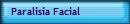 Paralisia Facial